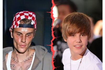 Justin Bieber fans beg him to ‘get help’ as he appears to be ‘seriously struggling’ in new photos: ‘Sad to watch’