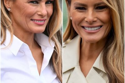 Melania Trump’s NEW FACE | Plastic Surgery Analysis