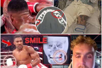 MMA World MOCKS Jake Paul And His JAW SURGERY! Emotional VIDEO Message!